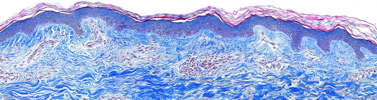 Skin - Models & Tests - Masson's Trichrome