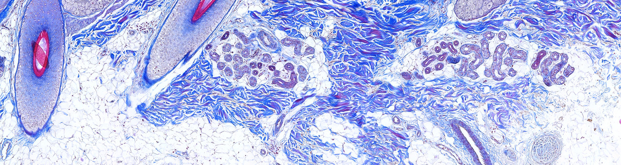 Skin Tests Subcutis -  Scalp Skin - Masson's Trichrome