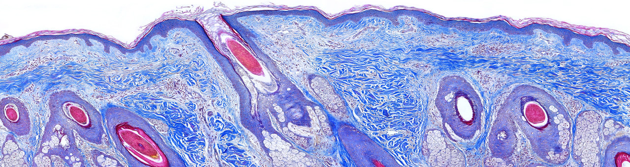 Screening Services - Scalp Skin - Masson's Trichrome