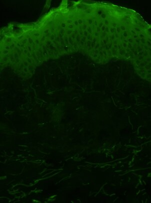 Skin Tests Oxidation - Skin non-oxidized DCFH-DA 