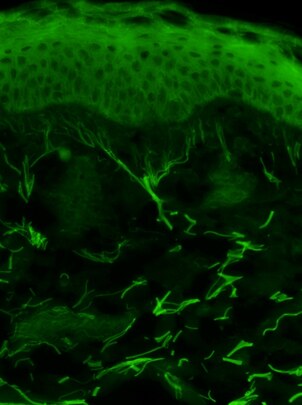 Skin Tests Oxidation - Skin oxidized DCFH-DA