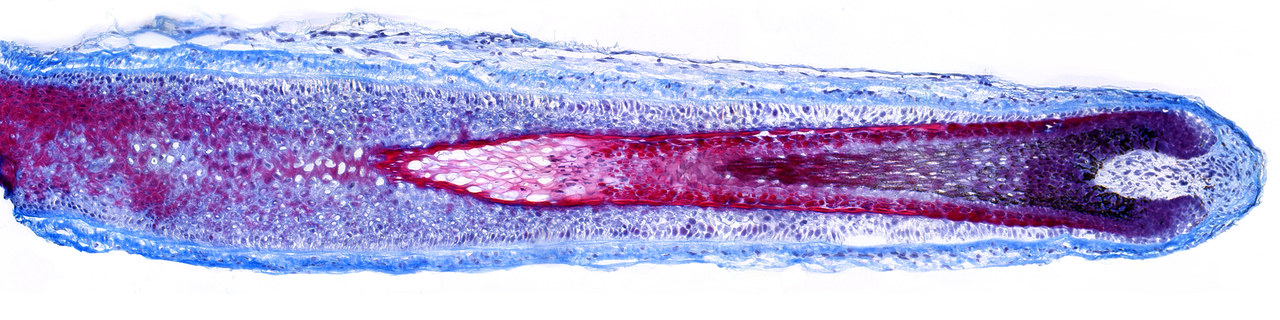 Hair Follicle - Masson's Trichrome Hair Tests - Stress Protection - Hair Follicle - Masson's Trichrome