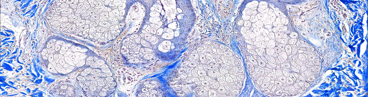 Skin Models & Tests -  Sebaceous Gland- Masson's Trichrome