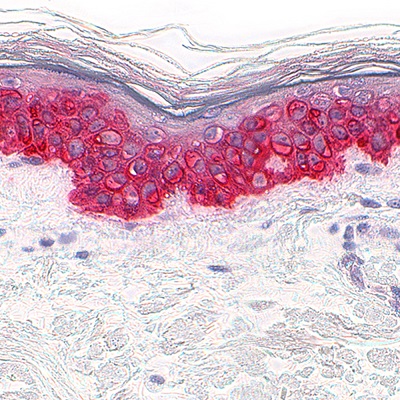 Skin Tests Intrinsic Aging - Skin - CK14