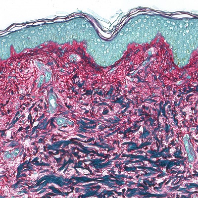 Skin Tests Intrinsic Aging - Skin - Picrosirius Red