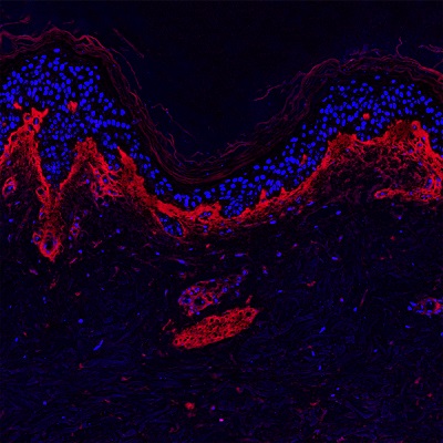 Skin Tests Intrinsic Aging - Skin Tenascin C