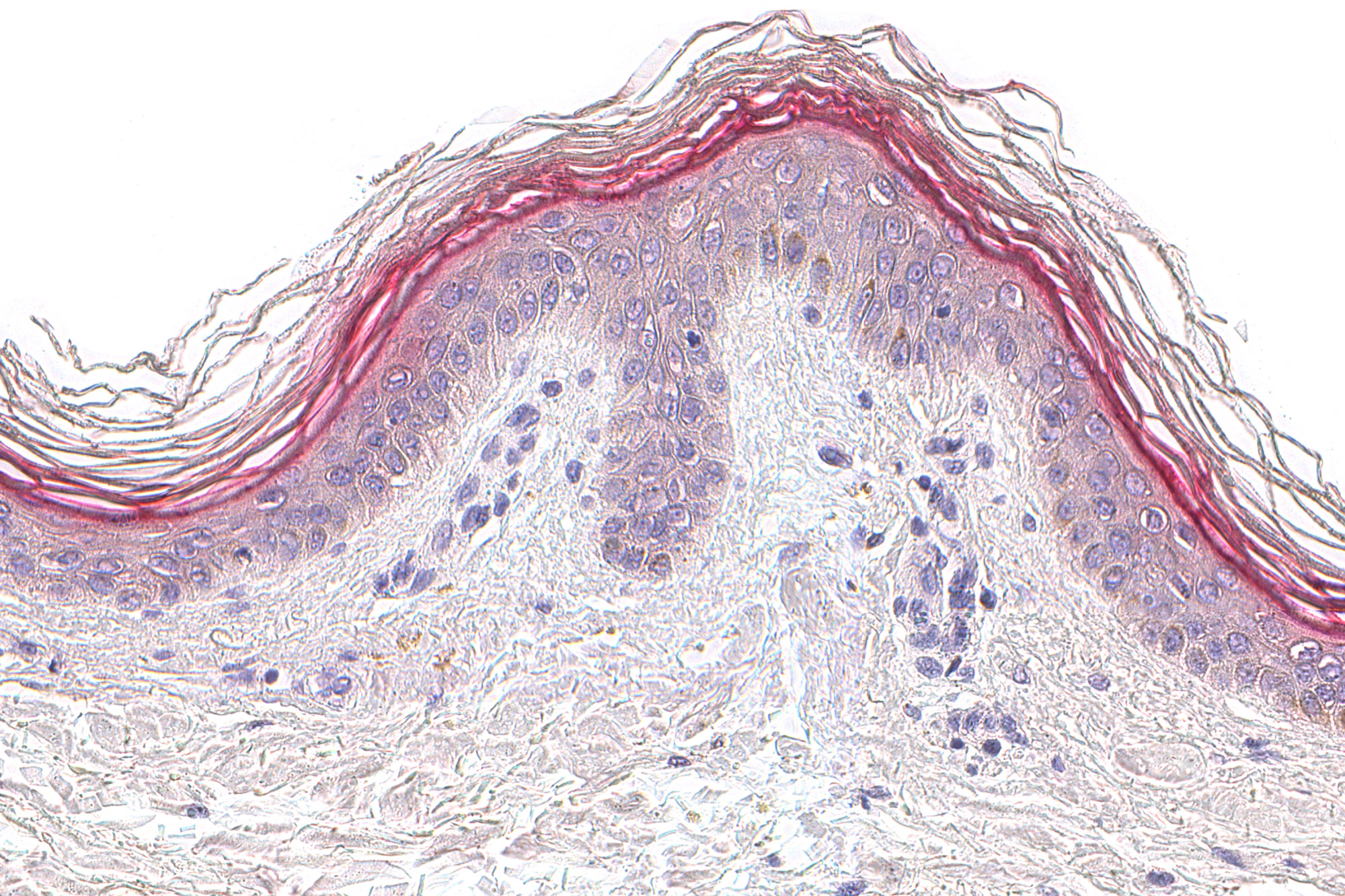 Skin Tests - Skin Barrier and Moisturization - Skin - Filaggrin