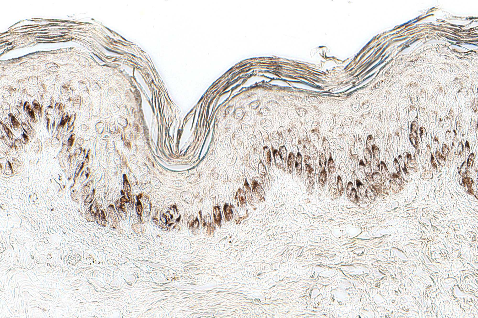 Skin Tests - Pigmentation - Skin - Fontana Masson