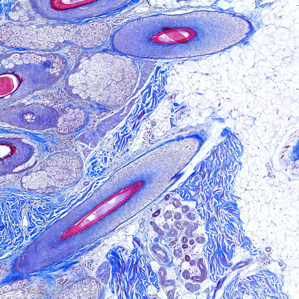 Subcutis Tests - Subcutaneous Fat – Masson’s Trichrome