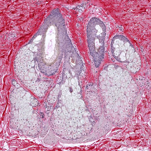 Sebaceous Gland - Collagen I