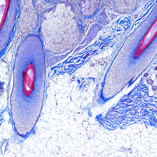 Subcutis Tests - Scalp Skin - Masson's Trichrome